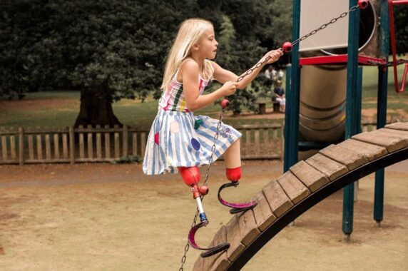 Photo of a girl with prosthetic legs climbing on playground equipment